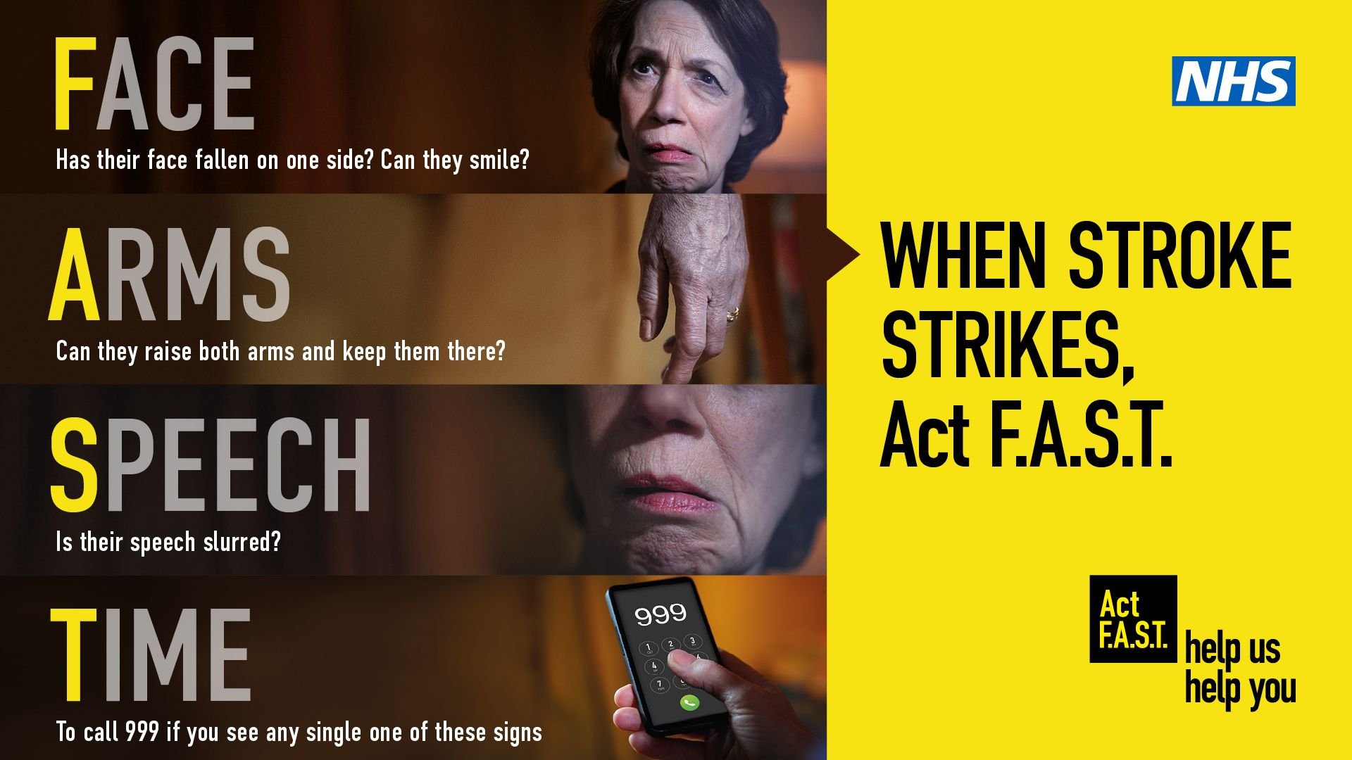 Act FAST on stroke