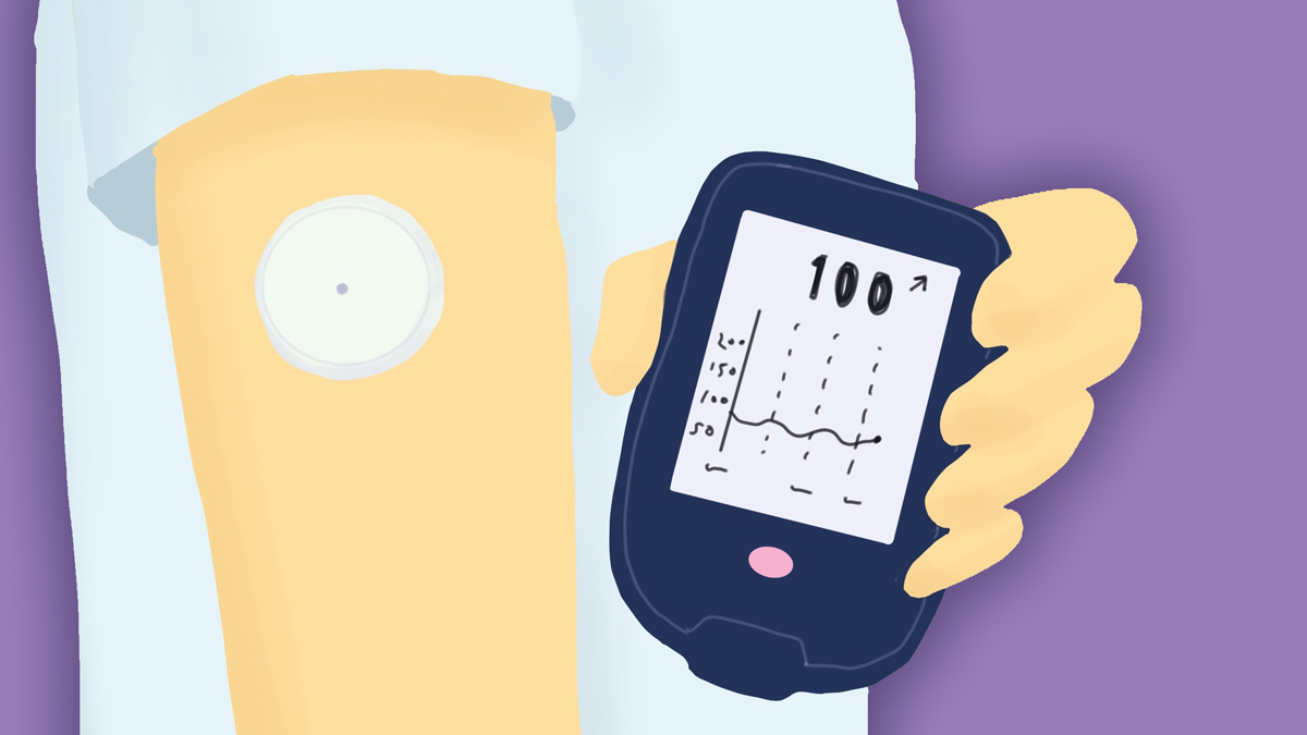 CGM device illustration.jpg