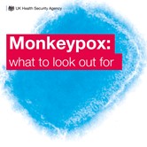 Monkeypox - what to look out for graphic