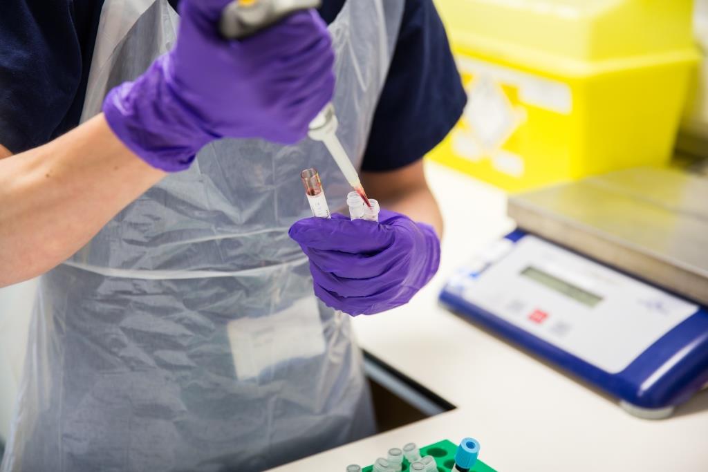 Lab technical processing a test sample