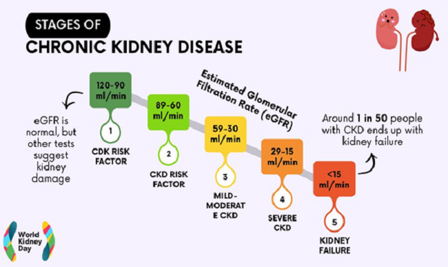 Graphic showing the stages of chronic kidney disease