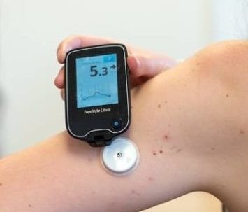 Flash-glucose-monitor.jpg